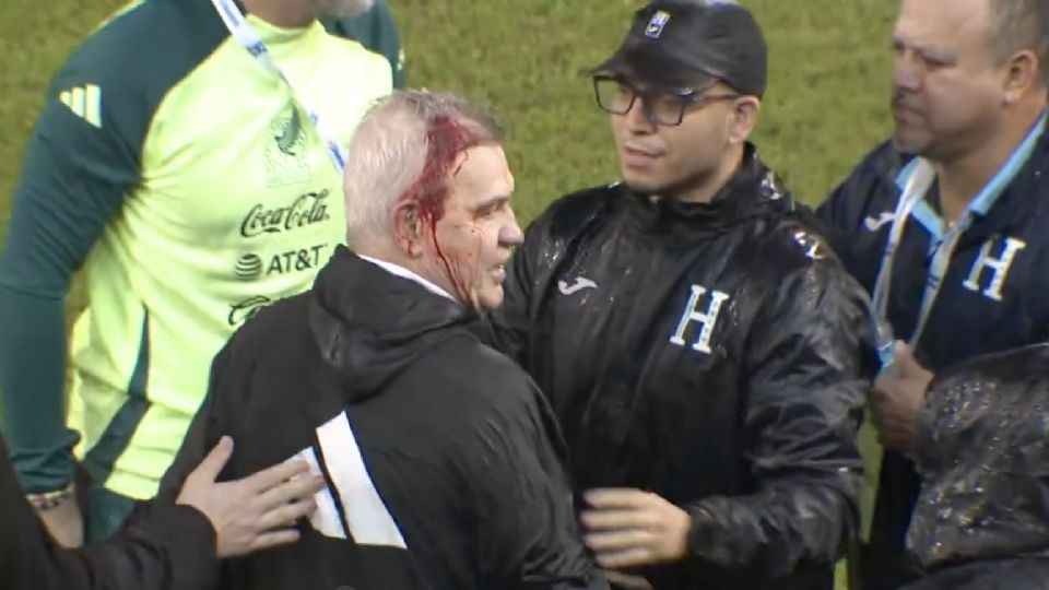 Aguirre sangra tras la agresión en Honduras.
