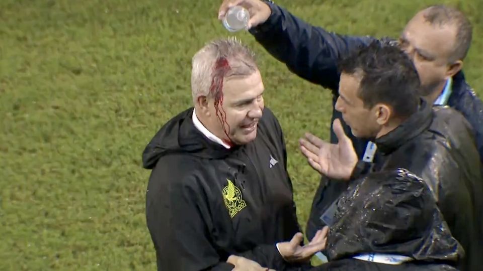 Javier Aguirre, tras la agresión.
