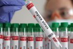OMS mantiene la emergencia internacional por la mpox ante el creciente número de casos