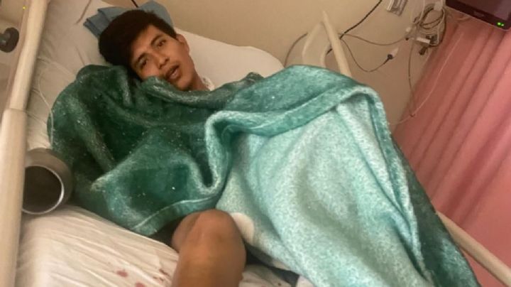 Joven indígena atropellado por funcionario del gobierno de SLP podría perder una pierna por falta de atención médica