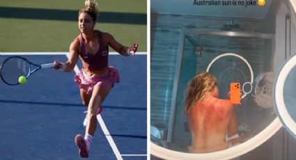 La tenista mexicana Renata Zarazúa muestra las huellas en su espalda por el clima en el torneo de Hobart: “El sol de Australia no es una broma”