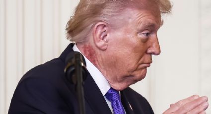 Trump presenta sarpullido en el cuello; su médico afirma que se trata de un tratamiento preventivo