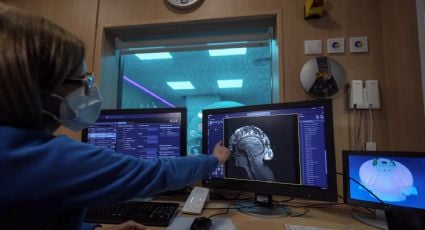 El rápido crecimiento del mal de Parkinson en México afectará en forma distinta a hombres y mujeres