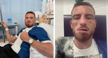 ¡Impactante! Peleador de ‘box a puño limpio’ sufre fractura de mandíbula tras cabezazo de un rival