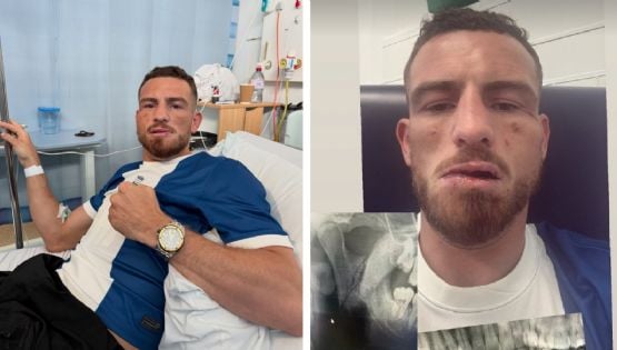 ¡Impactante! Peleador de ‘box a puño limpio’ sufre fractura de mandíbula tras cabezazo de un rival: es hospitalizado y anuncia su retiro