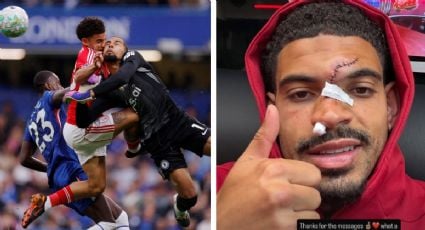 Jugador del Nottingham Forest requiere varios puntos de sutura en el rostro tras el impactante choque de cabezas contra el portero del Chelsea